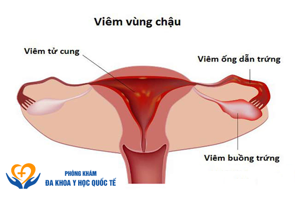 Vùng kín bị hôi, có mùi do yếu tố bệnh lý