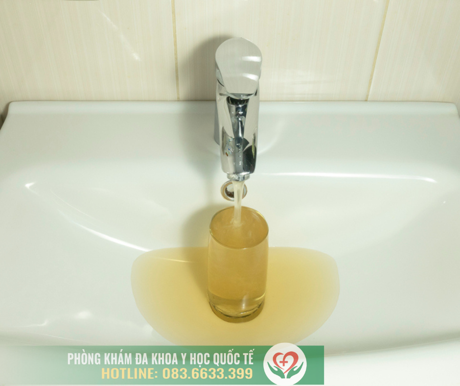 Viêm bao quy đầu ở trẻ có thể xuất phát từ việc vệ sinh ở nguồn nước không sạch sẽ