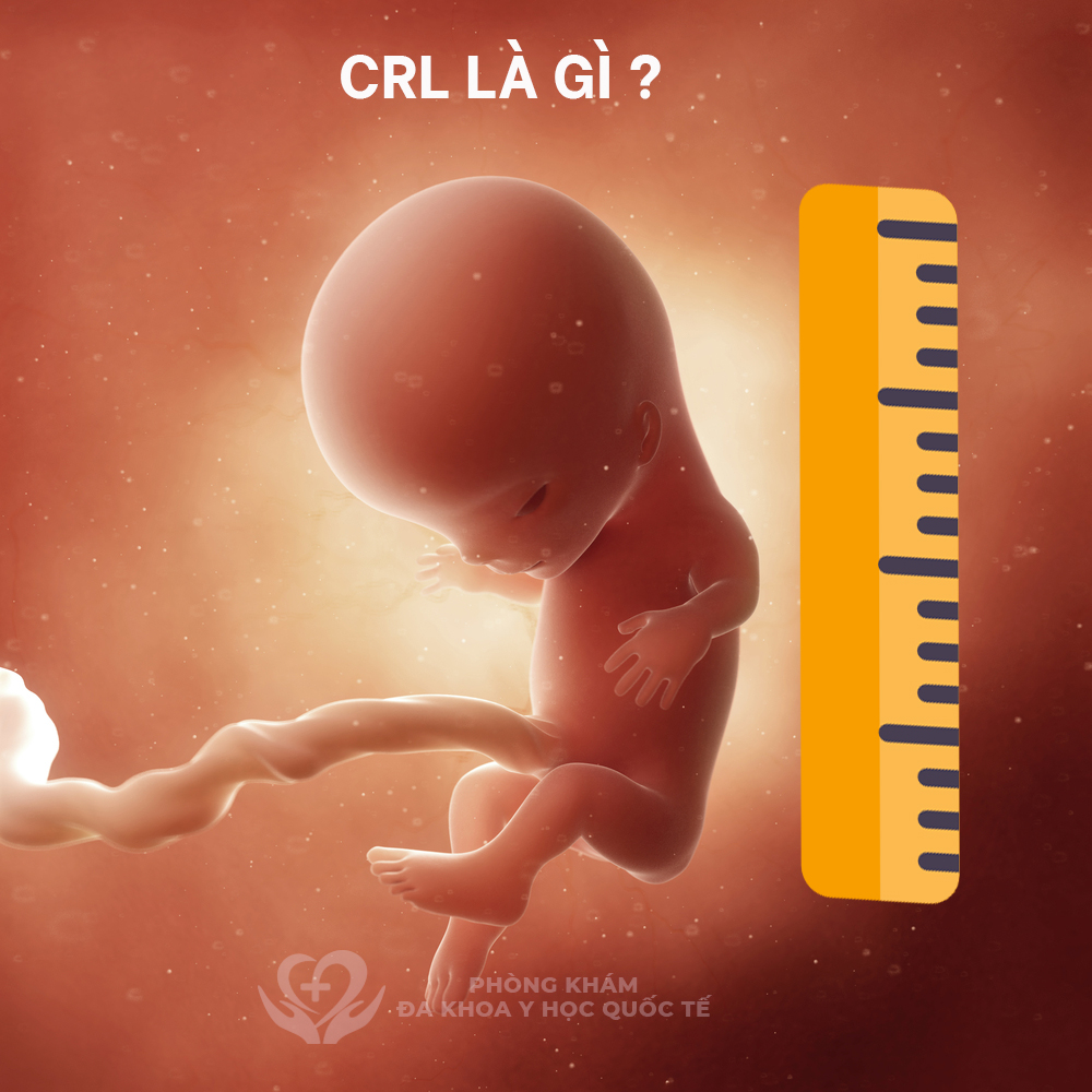 CRL LÀ GÌ 