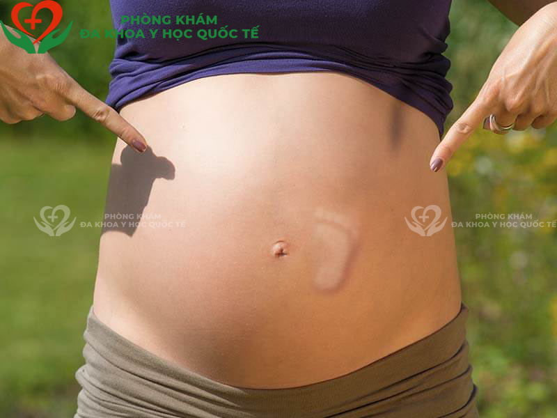 Thế nào là thai máy