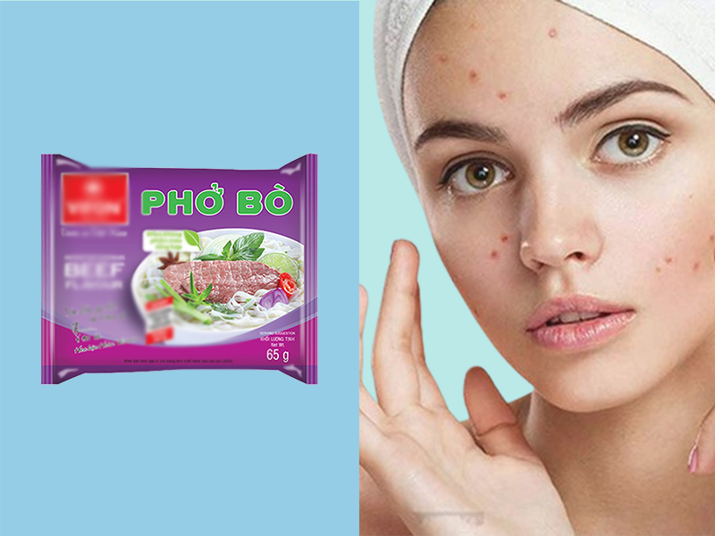 Ăn phở gói có nổi mụn không