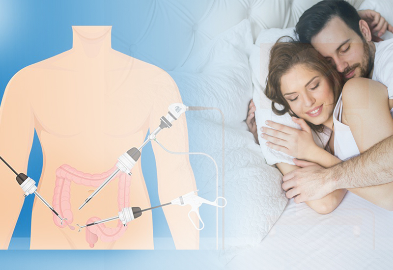 Mổ ruột thừa bao lâu quan hệ được