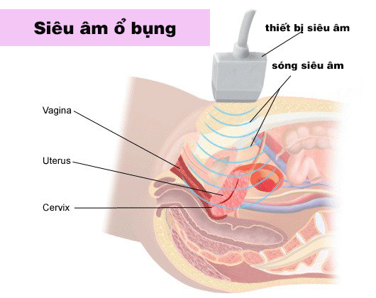 Các loại siêu âm 
