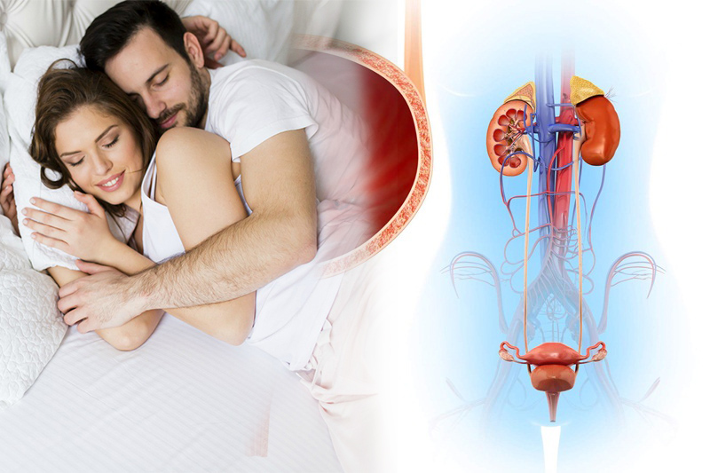 Có nên quan hệ với người bị viêm bàng quang