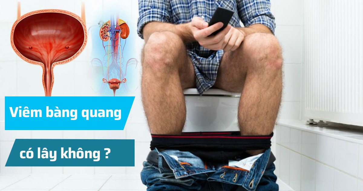 Viêm bàng quang có lây không