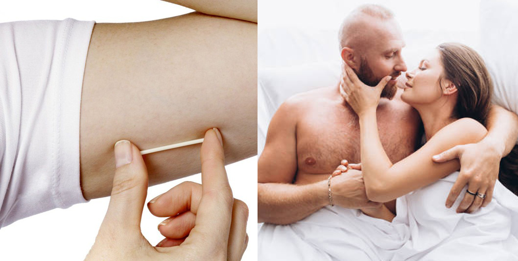 Cần kiêng quan hệ 7 ngày sau cấy que