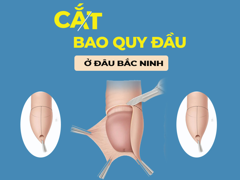 Địa chỉ cắt bao quy đầu uy tín ở Bắc Ninh