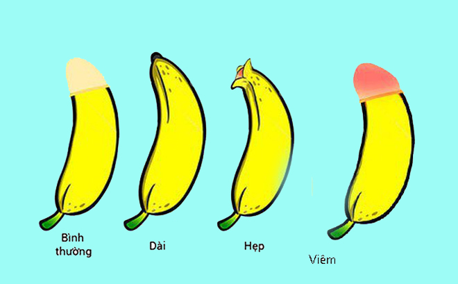 Lợi ích khi cắt bao quy đầu