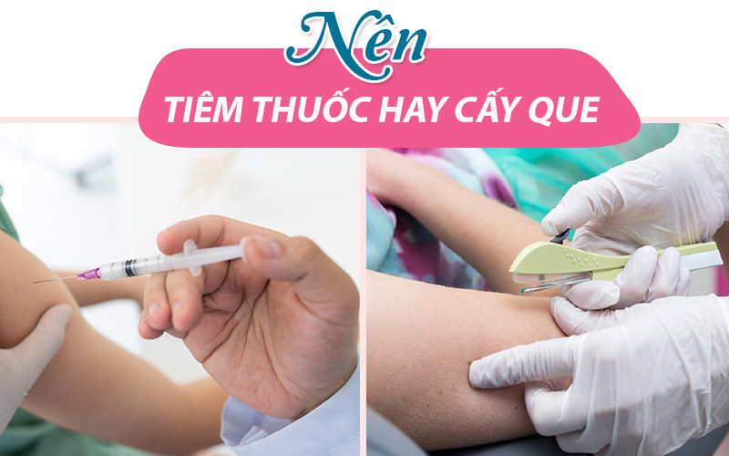 Nên tiêm thuốc tránh thai hay cấy que tránh thai