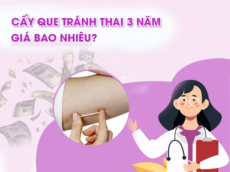 Cấy que tránh thai 3 năm giá bao nhiêu