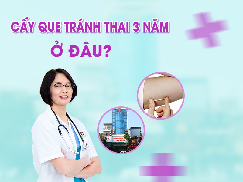 Cấy que tránh thai 3 năm ở đâu Hà Nội