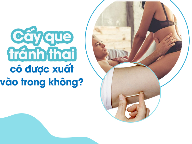 Cấy que tránh thai có được xuất vào trong không ?