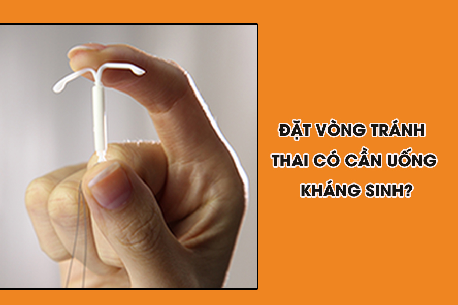Đặt vòng tránh thai có cần uống kháng sinh không