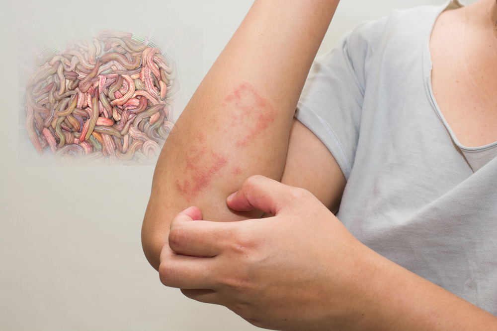 Người bị dị ứng không nên ăn rươi