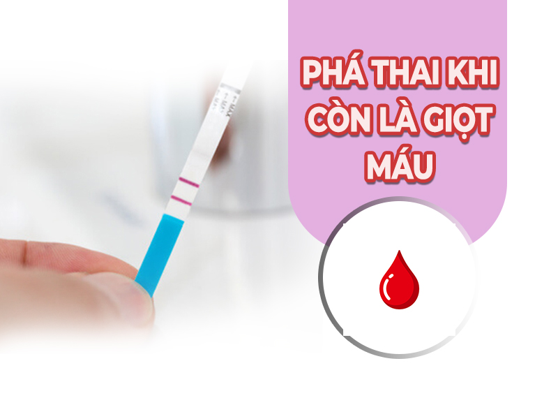 Phá thai khi còn là giọt máu