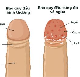 bao-quy-dau-bi-sung-do-va-ngua-la-benh-gi