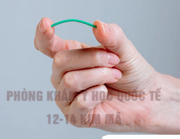 Que cấy tránh thai