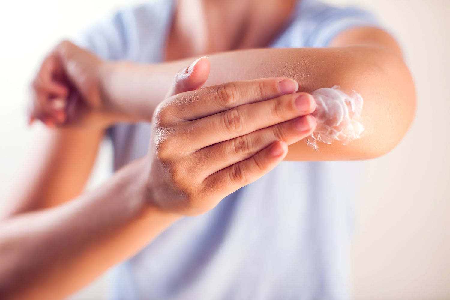 Làm gì khi bị ruồi vàng đốt