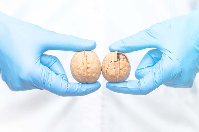 Cách kiểm tra bất thường ở tinh hoàn