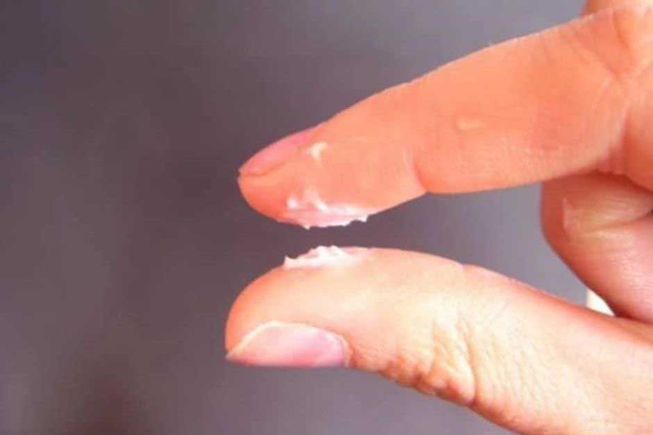 Tinh dịch vón cục như hạt gạo